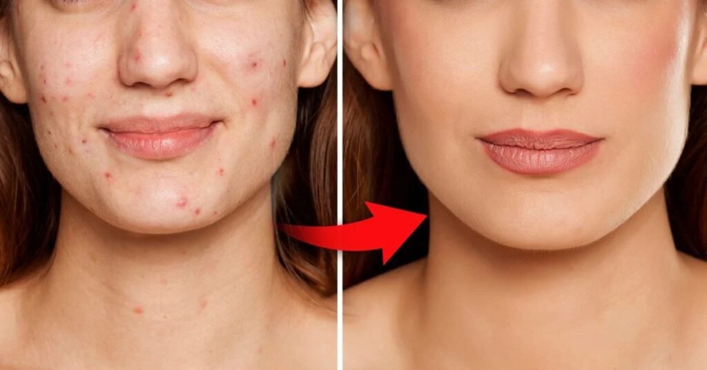 makeup for sensitive or acne-prone skin