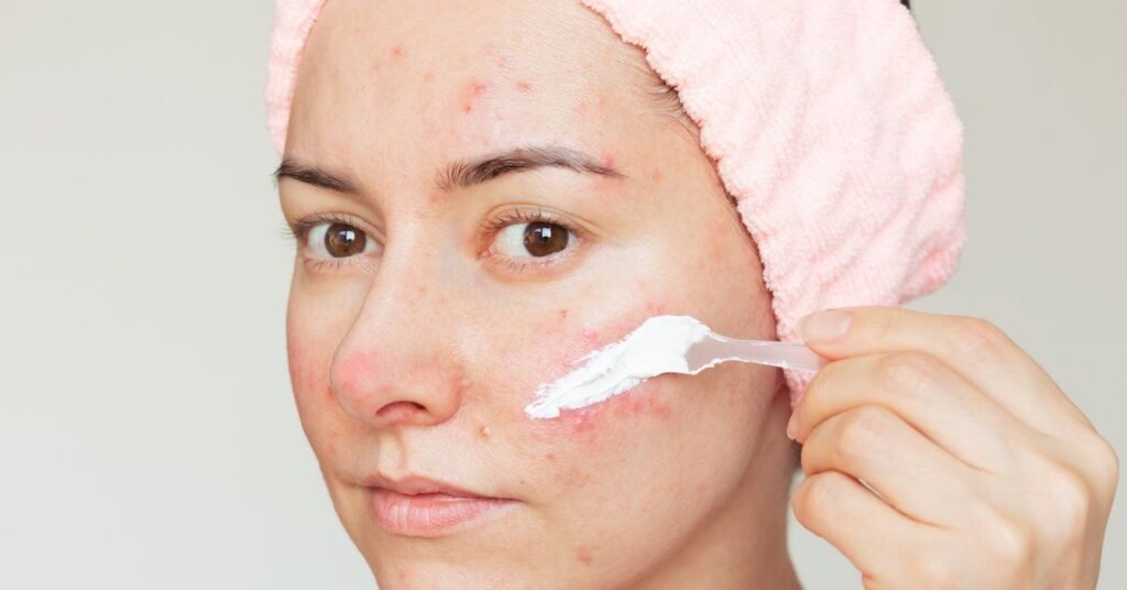 makeup-for-rosacea-skin
