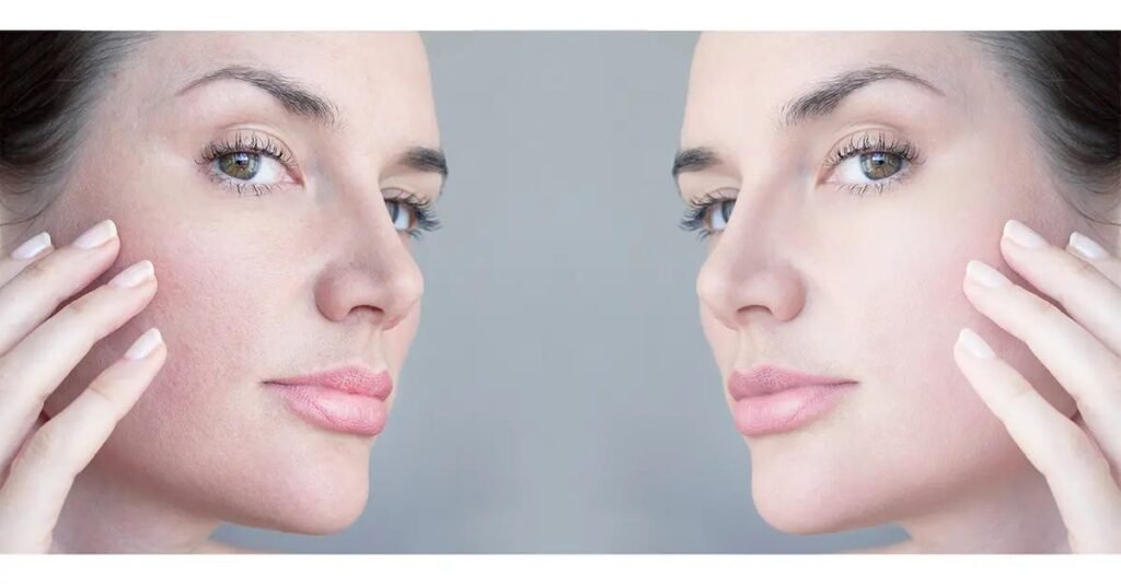 makeup for sensitive skin